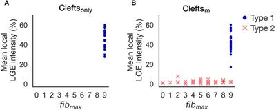 Fibrosis modeling choice affects morphology of ventricular arrhythmia in non-ischemic cardiomyopathy